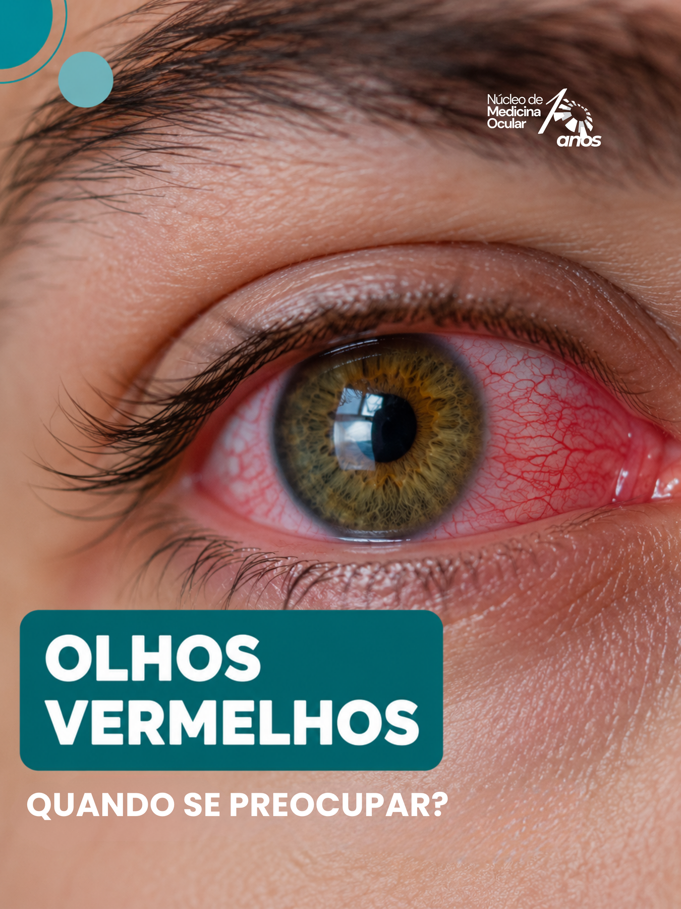 Prévia de olhos-vermelhos-final-aprovacao.png