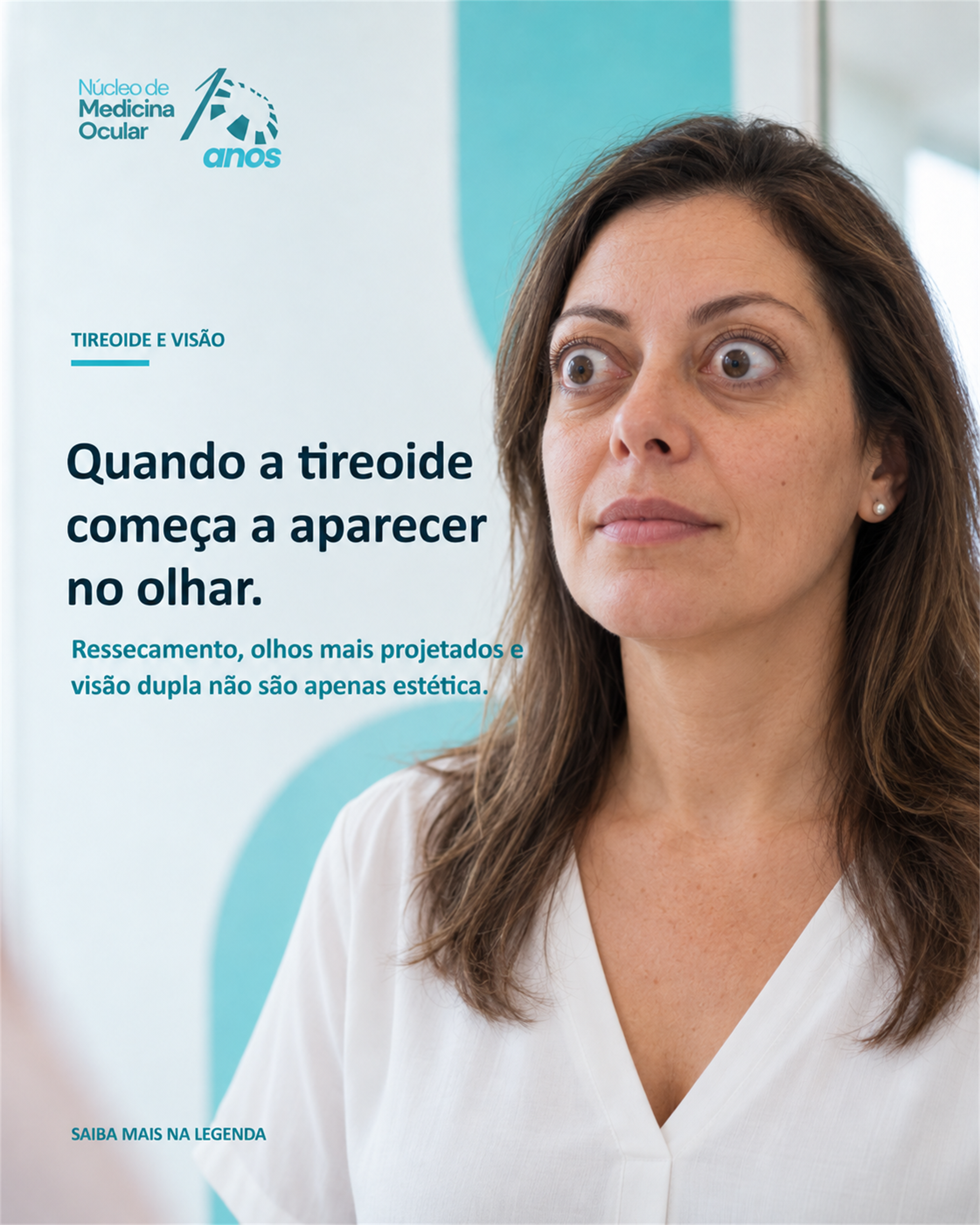 Prévia de post-05-tireoide-olhos-exoftalmo-v2.png